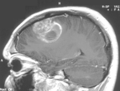 Screen Shot 2016-05-11 at 10.44.08 AM.png